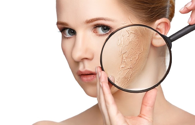 Làn da khô thường xuyên thiếu ẩm nên xảy ra hiện tượng bong tróc